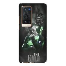 Чехол Криштиану Роналду для Vivo X60 Pro Plus (AlphaPrint) (Криштиано Лев)