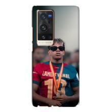 Чехол с футболистом Ламин Ямаль Vivo X60 Pro Plus (Ямаль Барса)