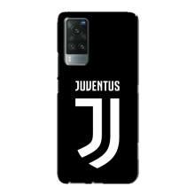 Чохли для Vivo X60 Pro (VPrint) - Футбольні клуби (ФК Ювентус)