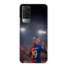 Чехол с футболистом Ламин Ямаль Vivo X60 Pro (Ямаль на стадионе)