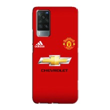 Силиконовые Чехлы принт Футбол на Vivo X60 Pro (Man United)