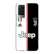 Чехлы для Vivo X60 (VPrint) - Футбольные клубы (Juventus)
