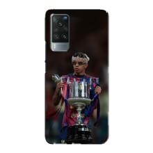 Чехол с футболистом Ламин Ямаль Vivo X60 – Ямал с кубком
