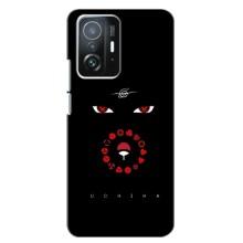 Чохли на тему: Ітачи Учіха для Xiaomi 11T / 11T Pro (AlphaPrint)