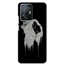 Чехол с Короной Сяоми 11т / 11т про - (AlphaPrint) – Принцесса