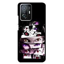 Чехлы Персонажи Аниме Наруто для Xiaomi 11T / 11T Pro (AlphaPrint)