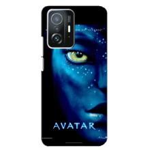 Чохли з фільму АВАТАР для Xiaomi 11T / 11T Pro (AlphaPrint)