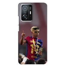 Чохол з футболістом Ламін Ямаль Xiaomi 11T / 11T Pro (Lamine Yamal)