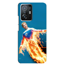 Чехол с принтом Фантастическая четверка для Xiaomi 11T / 11T Pro – Человек-Факел