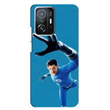 Чехол с принтом Фантастическая четверка для Xiaomi 11T / 11T Pro – Мистер Фантастик