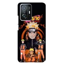 Naruto Anime Чохли для Шаомі 11Т / 11Т Про. (AlphaPrint)