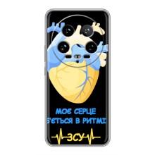 ЗСУ Чохли (TPU) для Xiaomi 14 Ultra – Ритм ЗСУ