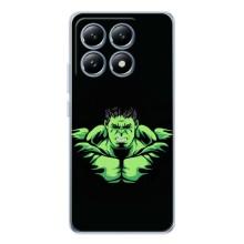 Чехлы с героями Марвел Xiaomi 14T Pro (VPrint)