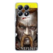 Чохол з картинкою (Патріотичний КОЗАК) на Xiaomi 14T Pro – Одноокий КОЗАК