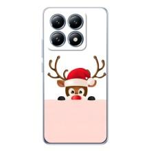 Чехол Санта Клаус для Xiaomi 14T Pro (Олененок)