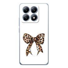 Чохол банти для Xiaomi 14T Pro