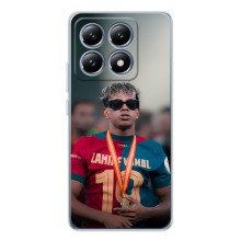 Чехол с футболистом Ламин Ямаль Xiaomi 14T Pro (Ямаль Барса)