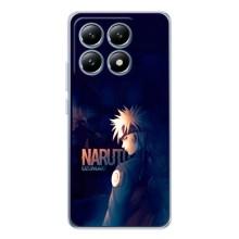 Naruto Anime Чехлы для Сяоми 14Т Про (AlphaPrint)