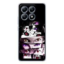Чохли Персонажі Аніме Наруто для Xiaomi 14T (AlphaPrint) – Очі Anime