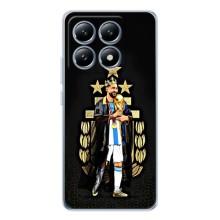 Чехлы для Xiaomi 14T (Leo чемпион) (AlphaPrint) – Месси Король