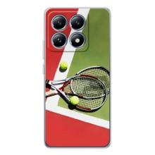 Чехлы с принтом Спортивная тематика для Xiaomi 14T – Ракетки теннис