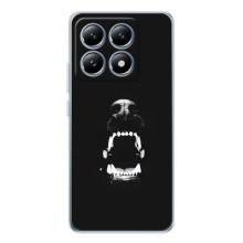 Чехол ДОБЕРМАН для Xiaomi 14T – Пасть добермана
