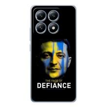 Чохол для Xiaomi 14T (AlphaPrint - с принтом Зеленського)