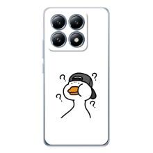 Бампер з принтом Меми для Xiaomi 15 Pro – Нерозуміння