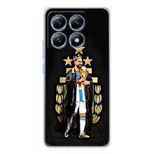 Чехлы для Xiaomi 15 Pro (Leo чемпион) (AlphaPrint) (Месси Король)