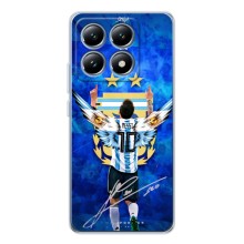 Чехлы для Xiaomi 15 Pro (Leo чемпион) (AlphaPrint) (Месси сборная)