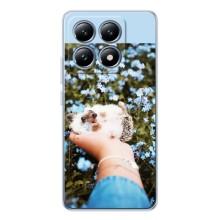 Чохли з зображенням різних тварин на Xiaomi 15 Pro (Їжачок в руці)