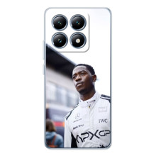 Чехол Формула1 на Xiaomi 15 Pro – Ф1 Пирс