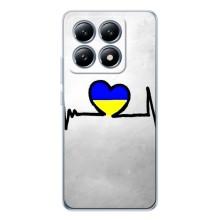 Силіконовий Чохол  на Xiaomi 15 Pro (Я-Україна) – Українська кардіограма
