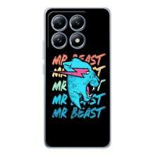 Чехлы Мистер Бист для Сяоми 15Т Про – logo Mr beast