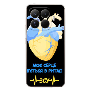 ЗСУ Чехлы (TPU) для Xiaomi 15T Pro – Ритм ЗСУ