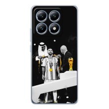 Чехлы для Xiaomi 15T (Leo чемпион) (AlphaPrint) (Месси в накидке)