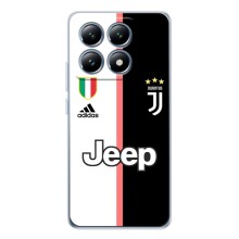 Чохли для Xiaomi 15T (VPrint) - Футбольні клуби (Juventus)