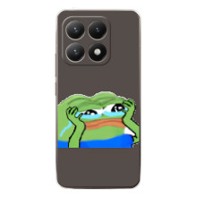 Чехлы с картинкой  Жаба Мем на Xiaomi 15T – Плач лягушки