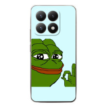 Чехлы с картинкой  Жаба Мем на Xiaomi 15T – Жаба все ОК