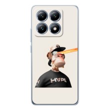 Чехлы с Обезьянами NFT для Xiaomi 15T (AlphaPrint) (обезьяна NFT в очках)