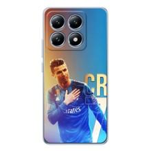 Чехол Криштиану Роналду для Xiaomi 15T (AlphaPrint) (CR7 Real)