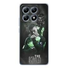 Чехол Криштиану Роналду для Xiaomi 15T (AlphaPrint) (Криштиано Лев)