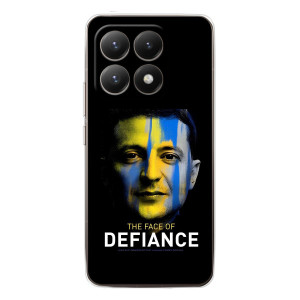 Чехол для Xiaomi 15T (AlphaPrint - с принтом Зеленского)