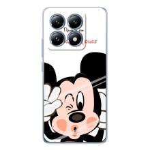 Эксклюзивный чехол для Xiaomi 15T (AlphaPrint - Мультяшные) (Маус Микки)