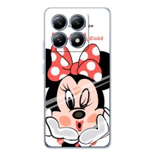 Эксклюзивный чехол для Xiaomi 15T (AlphaPrint - Мультяшные) (Маус Минни)