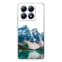 Силиконовый чехол с КАРТИНКАМИ лето для Xiaomi 15T (AlphaPrint) (Гори)