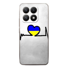 Силиконовый Чехол на Xiaomi 15T (Я-Украина) (Украинская кардиограмма)
