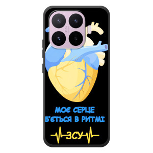 ЗСУ Чехлы (TPU) для Xiaomi 17T