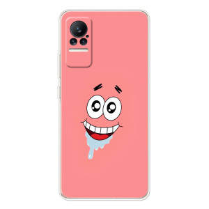 Чехлы с Патриком на Xiaomi Civi 1S – Мордочка Патрика