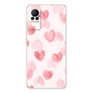 Чехол с розовым рисунком для Xiaomi Civi 1S